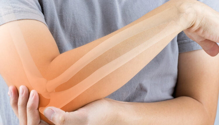 romatizma hastalari kaplicaya gidebilir mi